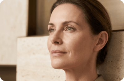 Woman with fine lines and loss of facial volume