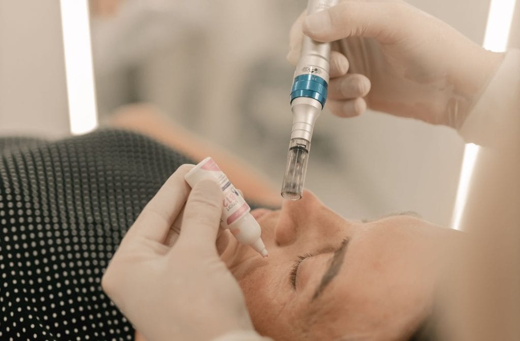Microneedling with Exosomes: What a Randomized Split-Face Study Found image